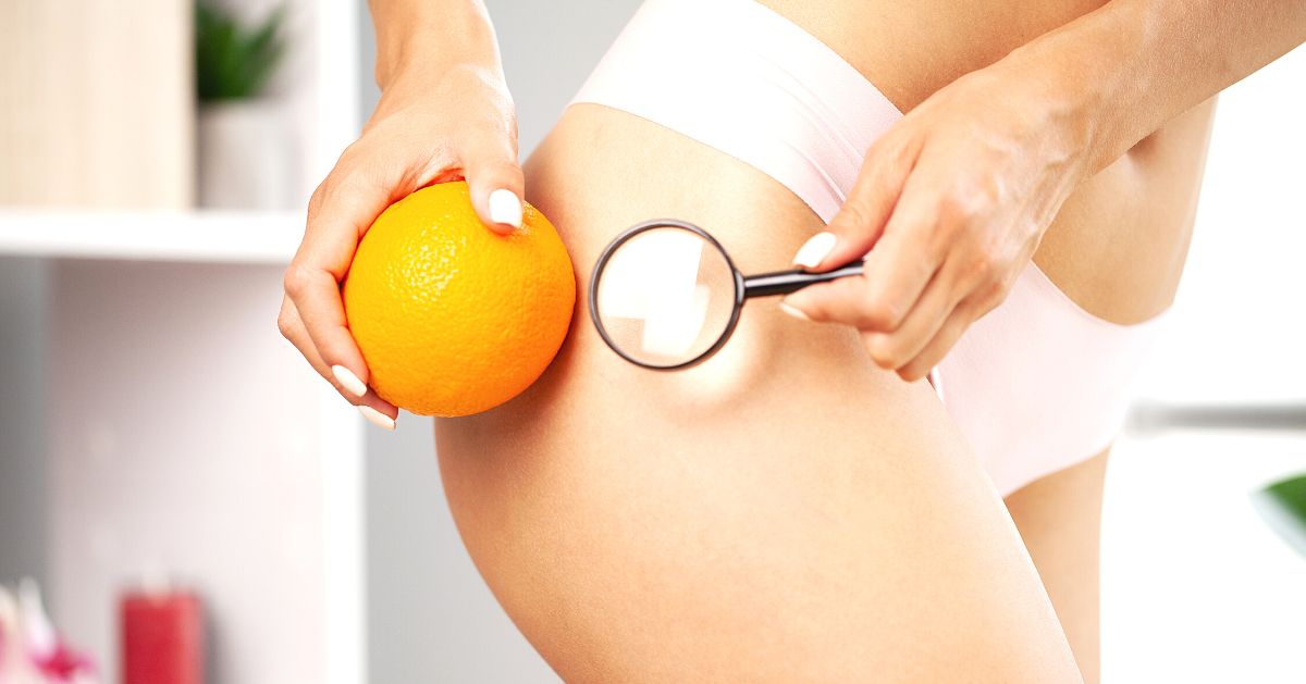 Anti-Cellulite-Drainagemittel, eine wirksame Ergänzung